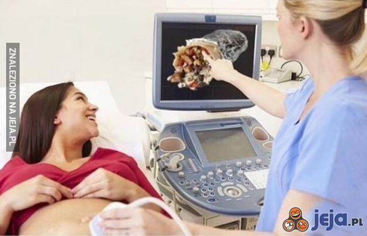 Bezpieczne jedzenie w ciąży