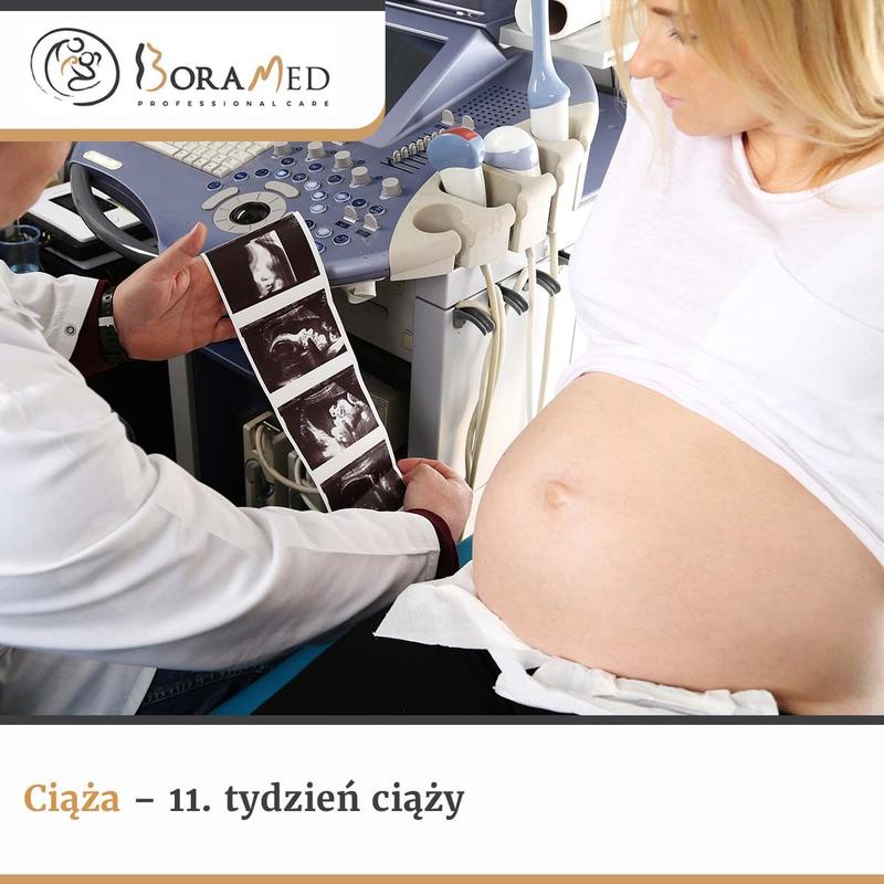 Zdrowa dieta ciążowa