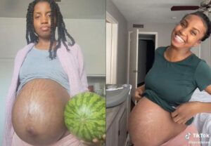 Czy arbuzy w ciąży to zdrowy wybór? Sprawdź, czy można jeść te soczyste owoce!