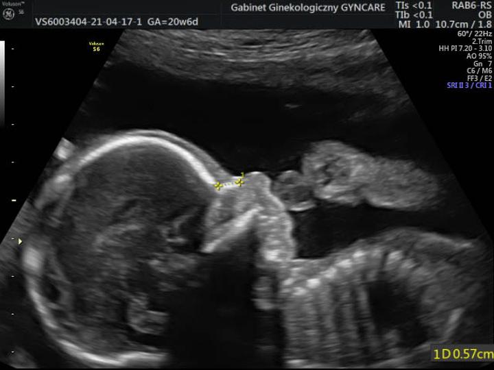 Harmonogram badań prenatalnych