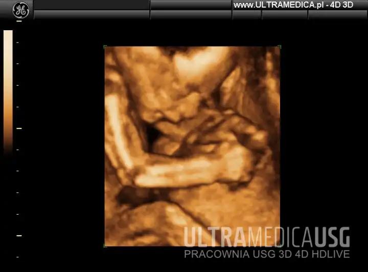 Usg połówkowe: Co warto wiedzieć, kiedy je wykonać i o co pytać?